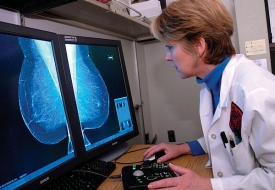Mary Mahoney directs the digital mammography screening center at the Barrett Cancer Center where she was interviewed by the N.Y. Times. Photo/David Collins