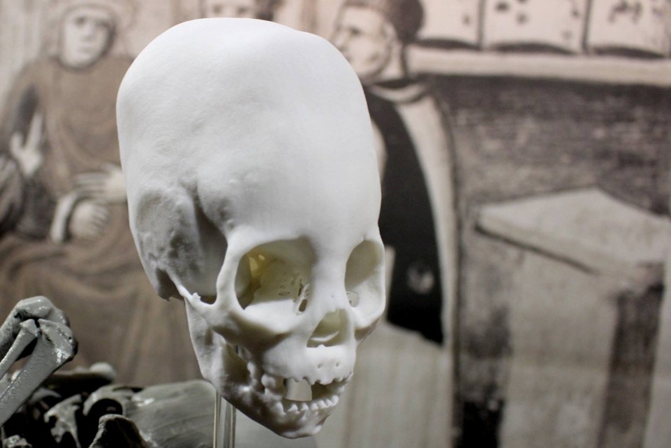 A 3-D printed image of a skull of a 300-year-old mummified Peruvian child.